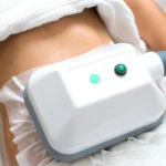 CoolSculpting