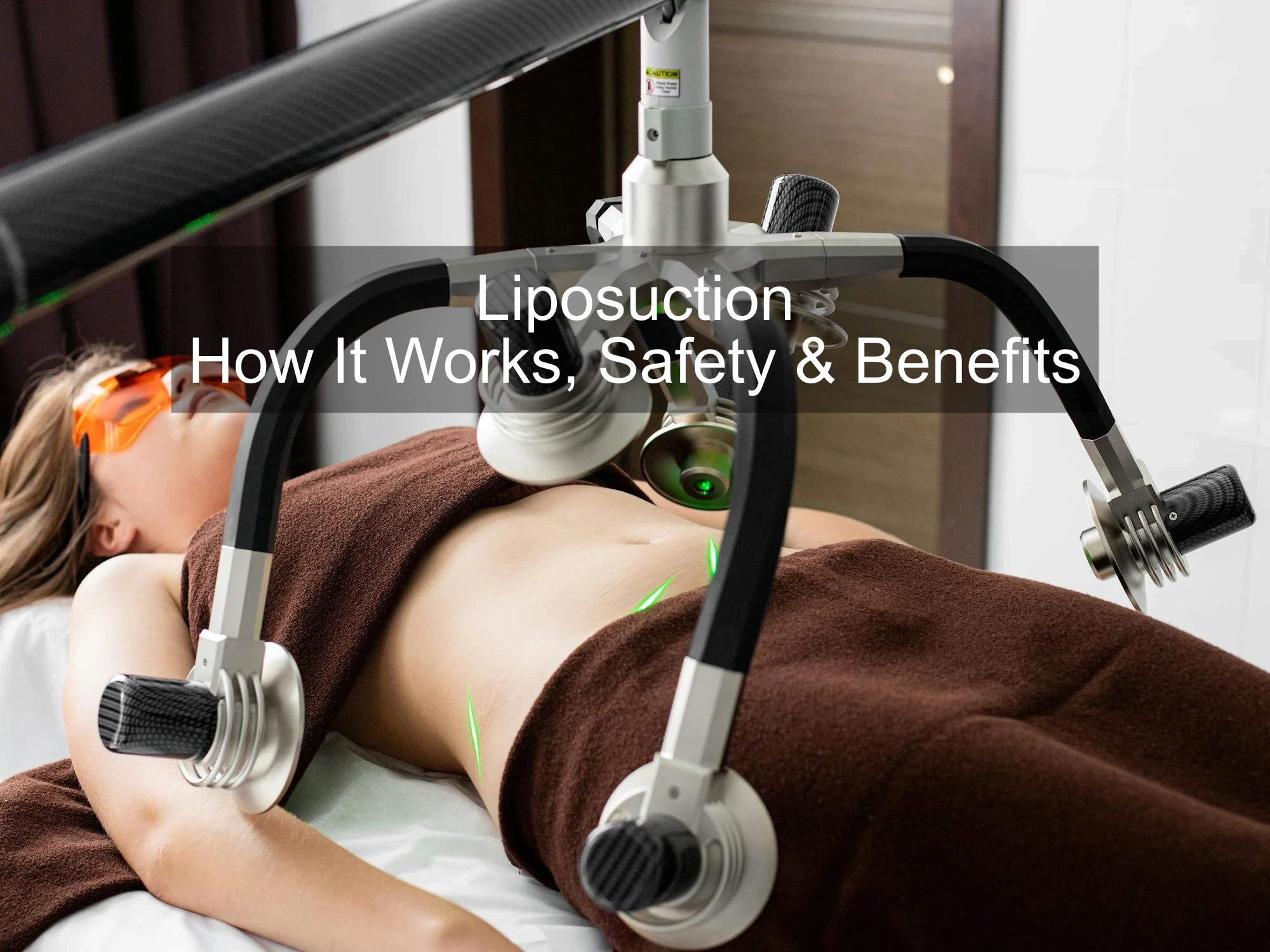 Liposuction